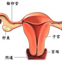 附件炎